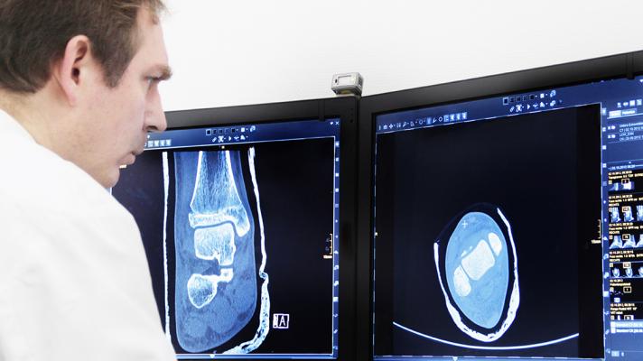 Radiologist examines X-ray