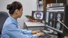 A radiologist reviewing a brain scan